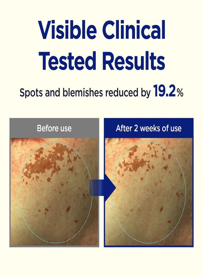 CKD Guaranteed CKD Triple Blemish Under Eye Gel Patch 60 Counts - Hydrogel Spot Treatment, Gentle Formula for Blemish Improvement, Even Tone and Minimize Puffiness with 99% Pure Vitamin C and Teca. - Image 5
